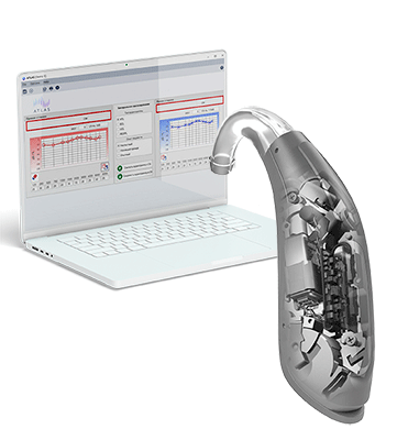Индивидуальная настройка слухового аппарата в Костроме